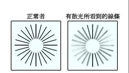眼睛看不清，好视力眼贴教你判断是否有这种状况出现！
