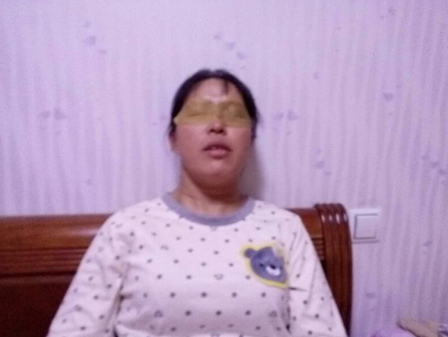 眼贴缓解了眼睛2200度的痛苦